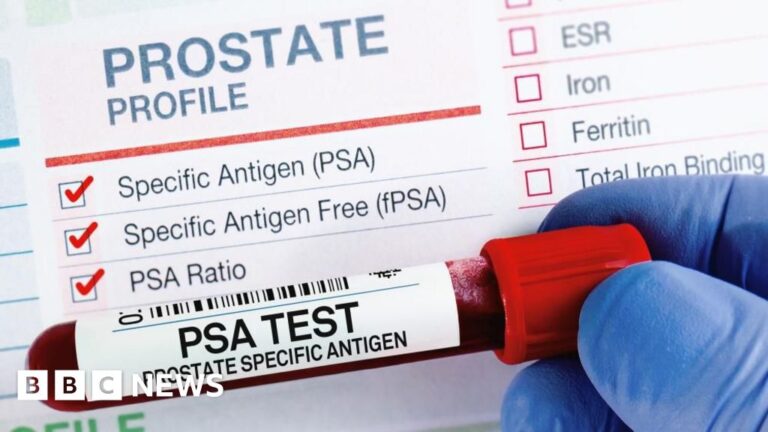 Read more about the article Devon group calls for more tests to screen for prostate cancer