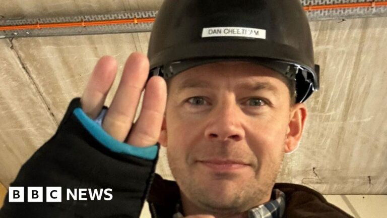 Read more about the article Devon man loses finger 13 years after black widow spider bite