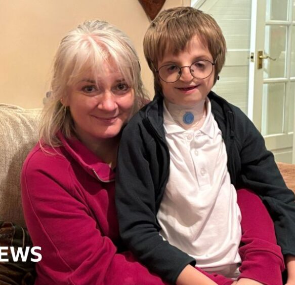 ‘Life-changing’ surgery gives Bath boy ‘first ever sleepover’