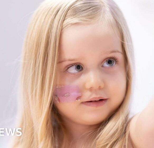 Bournemouth girl is department’s 1,000th radiotherapy patient