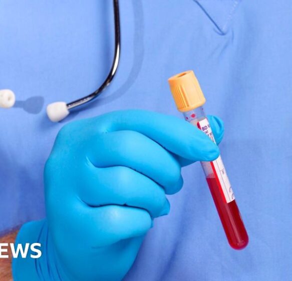 HIV detection drive sees thousands tested in A&E