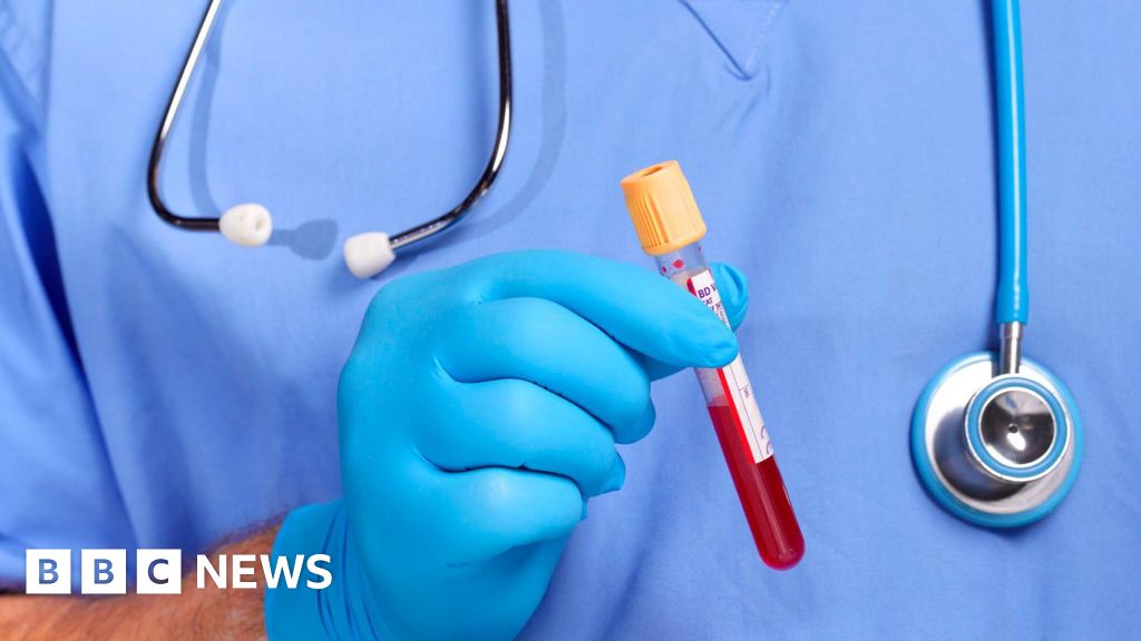 You are currently viewing HIV detection drive sees thousands tested in A&E