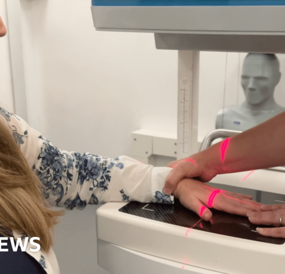 Exeter woman first to trial 3D scan for early arthritis diagnosis