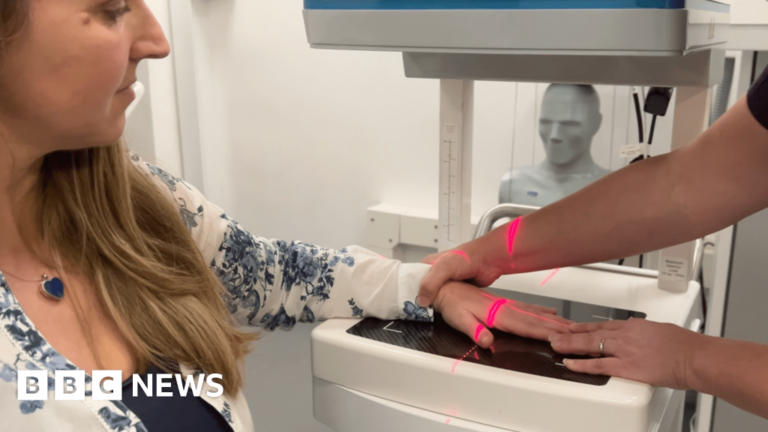 Read more about the article Exeter woman first to trial 3D scan for early arthritis diagnosis