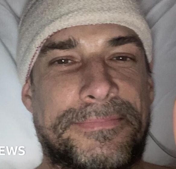 New treatments hoped for brain tumour patients in Plymouth