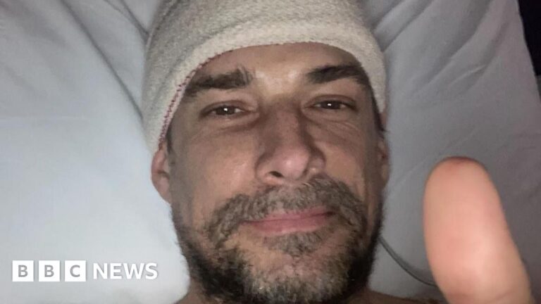 Read more about the article New treatments hoped for brain tumour patients in Plymouth