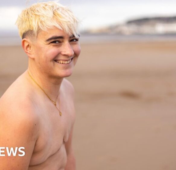 Weston woman with double mastectomy runs topless for charity