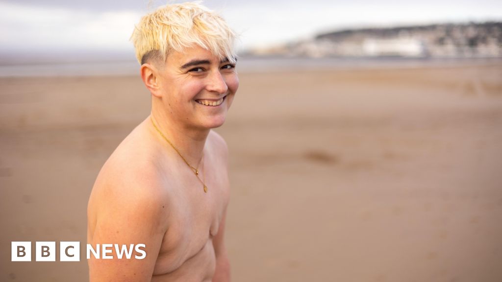 You are currently viewing Weston woman with double mastectomy runs topless for charity